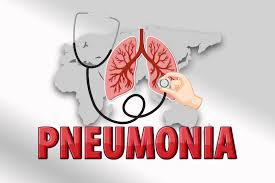 Pneumonia